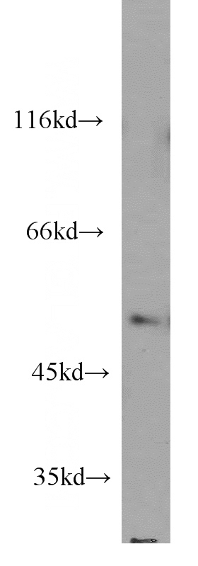 HeLa cells were subjected to SDS PAGE followed by western blot with Catalog No:110189(EIF2S3 antibody) at dilution of 1:1000