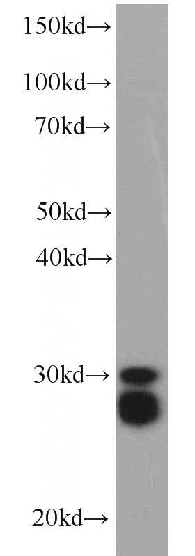 Jurkat cells were subjected to SDS PAGE followed by western blot with Catalog No:109527(CPSF4 antibody) at dilution of 1:300