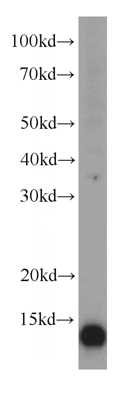 Jurkat cells were subjected to SDS PAGE followed by western blot with Catalog No:116449(TXNDC17 antibody) at dilution of 1:500