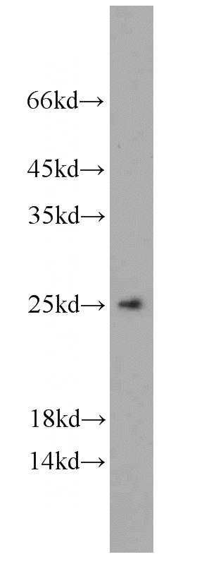 HEK-293 cells were subjected to SDS PAGE followed by western blot with Catalog No:113742(PCMT1 antibody) at dilution of 1:1000