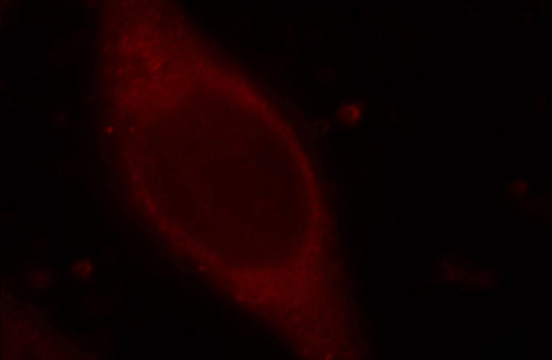 Immunofluorescent analysis of Hela cells, using TMEM176A antibody Catalog No:116107 at 1:25 dilution and Rhodamine-labeled goat anti-rabbit IgG (red).
