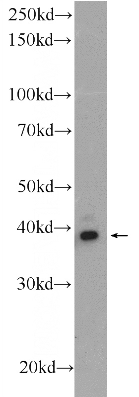 PC-13 cells were subjected to SDS PAGE followed by western blot with Catalog No:113737(PCGF6 Antibody) at dilution of 1:1500