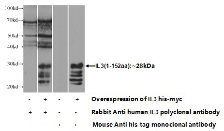 Transfected HEK-293 cells were subjected to SDS PAGE followed by western blot with Catalog No:111735(IL3 Antibody) at dilution of 1:1000