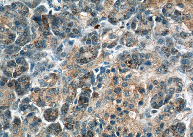 Immunohistochemical of paraffin-embedded human pancreas using Catalog No:116036(THADA antibody) at dilution of 1:50 (under 40x lens)