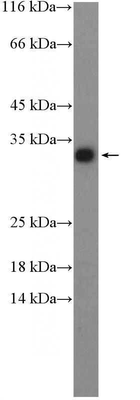 mouse liver tissue were subjected to SDS PAGE followed by western blot with Catalog No:111388(HDHD2 Antibody) at dilution of 1:1000
