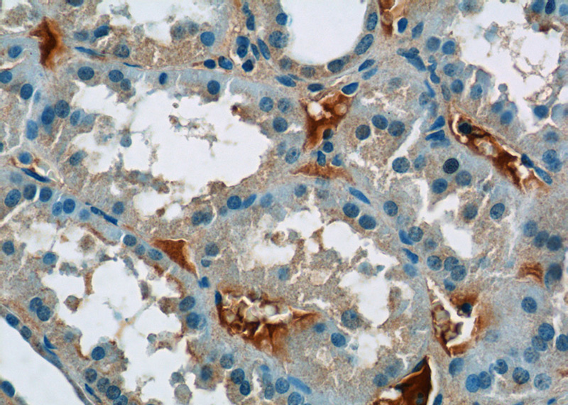 Immunohistochemistry of paraffin-embedded human kidney tissue slide using Catalog No:110396(EPSTI1 Antibody) at dilution of 1:50 (under 40x lens)