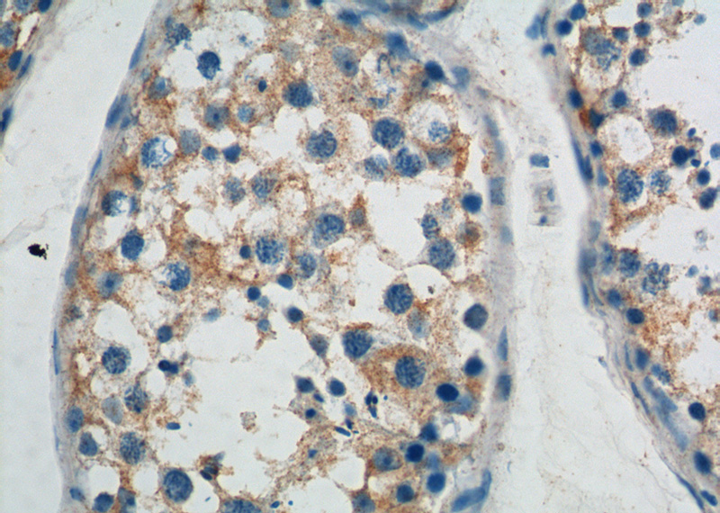 Immunohistochemistry of paraffin-embedded human testis tissue slide using Catalog No:108318(ATP9A Antibody) at dilution of 1:200 (under 40x lens).