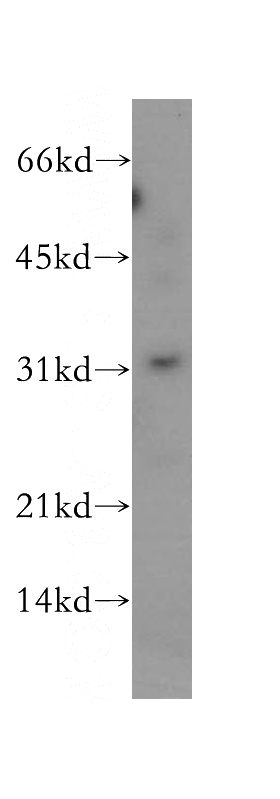 human kidney tissue were subjected to SDS PAGE followed by western blot with Catalog No:114250(PSMF1 antibody) at dilution of 1:500