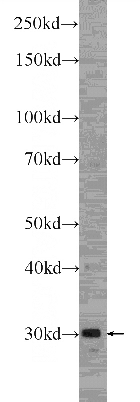 mouse skeletal muscle tissue were subjected to SDS PAGE followed by western blot with Catalog No:115512(SOX15 Antibody) at dilution of 1:300