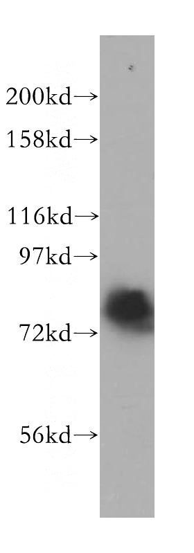 HepG2 cells were subjected to SDS PAGE followed by western blot with Catalog No:114722(RMI1 antibody) at dilution of 1:500