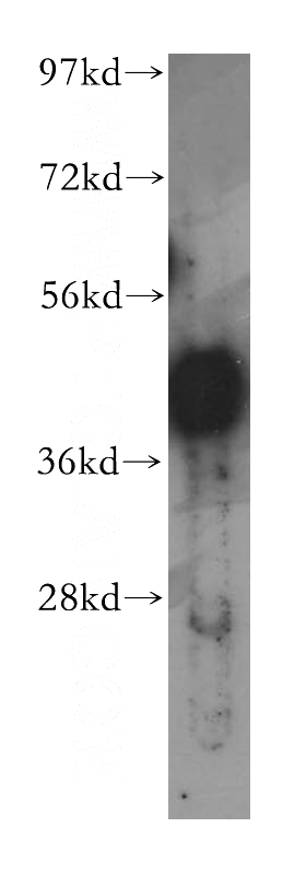 HeLa cells were subjected to SDS PAGE followed by western blot with Catalog No:113815(PHF6 antibody) at dilution of 1:1000