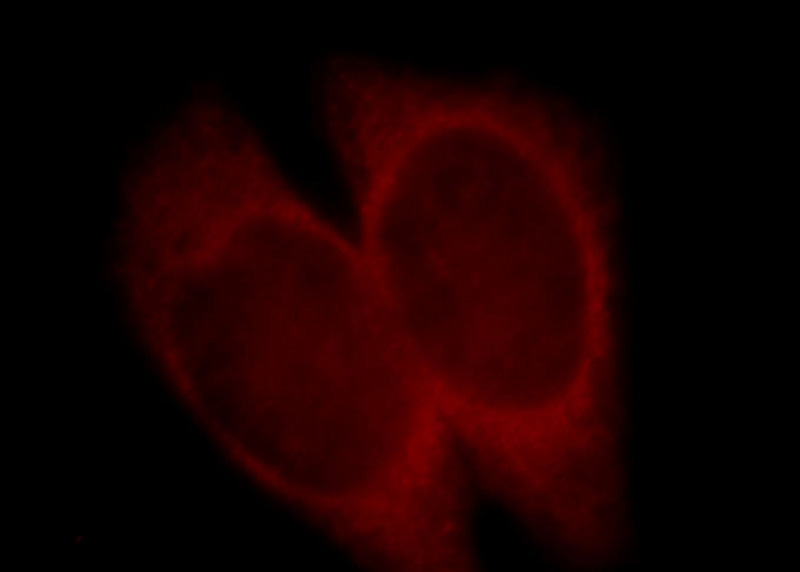 Immunofluorescent analysis of Hela cells, using TNFRSF1B antibody Catalog No:116290 at 1:25 dilution and Rhodamine-labeled goat anti-rabbit IgG (red).