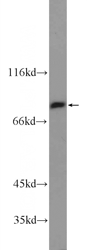 mouse skin tissue were subjected to SDS PAGE followed by western blot with Catalog No:116031(TGM5 Antibody) at dilution of 1:600