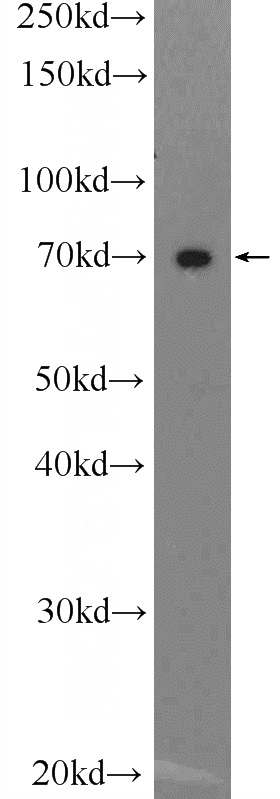 ROS1728 cells were subjected to SDS PAGE followed by western blot with Catalog No:107829(ACAN Antibody) at dilution of 1:600