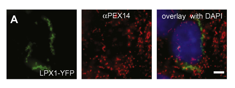 The antibody Catalog No:113727 stain the Peroxisomes of the COS7 cell transfected with YFP-Lpx1. IF result in Paper with PMID:21741480, Dr. Sven Thoms.
