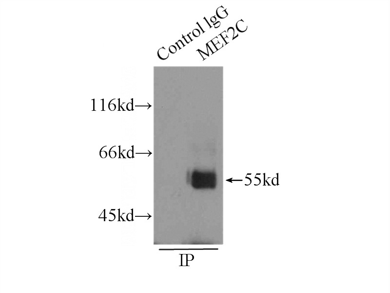 IP Result of anti-MEF2C (IP:Catalog No:112632, 3ug; Detection:Catalog No:112632 1:500) with SH-SY5Y cells lysate 2000ug.
