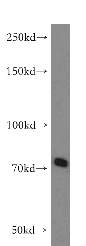 mouse thymus tissue were subjected to SDS PAGE followed by western blot with Catalog No:107800(ABCB9 antibody) at dilution of 1:500