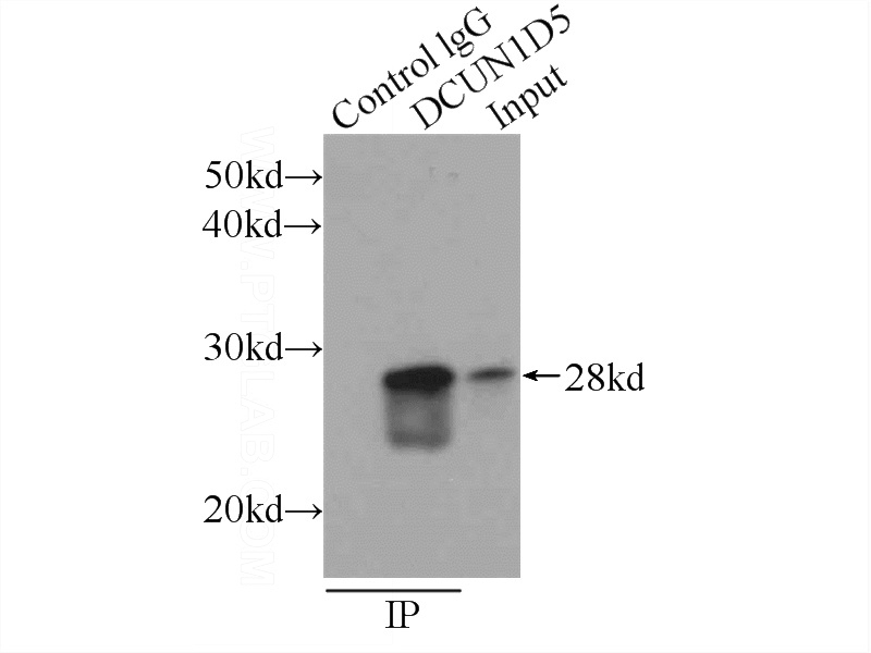 IP Result of anti-DCUN1D5 (IP:Catalog No:109765, 3ug; Detection:Catalog No:109765 1:800) with HeLa cells lysate 1840ug.