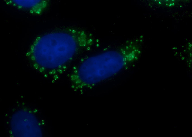 Immunofluorescent analysis of HepG2 cells using Catalog No:109201(CFTR Antibody) at dilution of 1:50 and Alexa Fluor 488-congugated AffiniPure Goat Anti-Rabbit IgG(H+L)