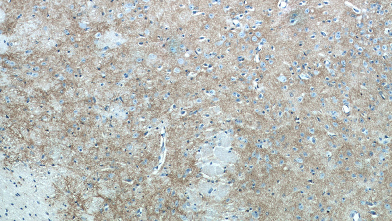 Immunohistochemistry of paraffin-embedded mouse brain tissue slide using Catalog No:112064(KCNJ10 Antibody) at dilution of 1:50 (under 10x lens)
