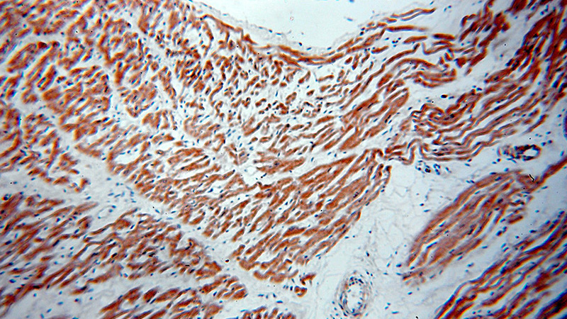 Immunohistochemical of paraffin-embedded human heart using Catalog No:110802(GABARAPL2-Specific antibody) at dilution of 1:50 (under 10x lens)