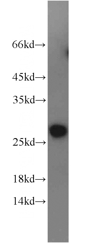 human liver tissue were subjected to SDS PAGE followed by western blot with Catalog No:113757(PCTP antibody) at dilution of 1:300