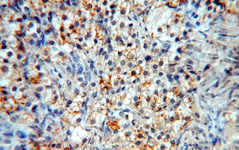 Immunohistochemical of paraffin-embedded human ovary using Catalog No:108978(CCDC51 antibody) at dilution of 1:100 (under 40x lens)