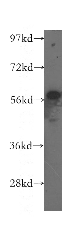 human liver tissue were subjected to SDS PAGE followed by western blot with Catalog No:112544(MCCC2 antibody) at dilution of 1:400