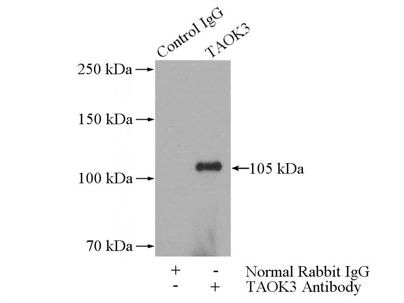 IP Result of anti-TAOK3 (IP:Catalog No:115849, 4ug; Detection:Catalog No:115849 1:700) with HepG2 cells lysate 3600ug.