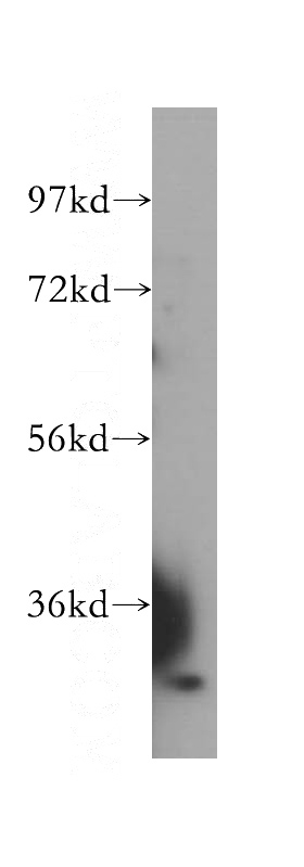 HeLa cells were subjected to SDS PAGE followed by western blot with Catalog No:109915(DHDDS antibody) at dilution of 1:500