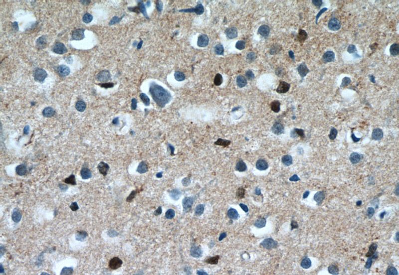 Immunohistochemistry of paraffin-embedded human brain tissue slide using Catalog No:113202(NKX1-2 Antibody) at dilution of 1:50 (under 40x lens)