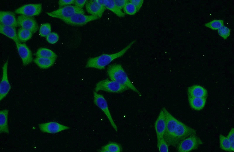 Immunofluorescent analysis of HeLa cells using Catalog No:110335(ENTPD7 Antibody) at dilution of 1:50 and Alexa Fluor 488-congugated AffiniPure Goat Anti-Rabbit IgG(H+L)