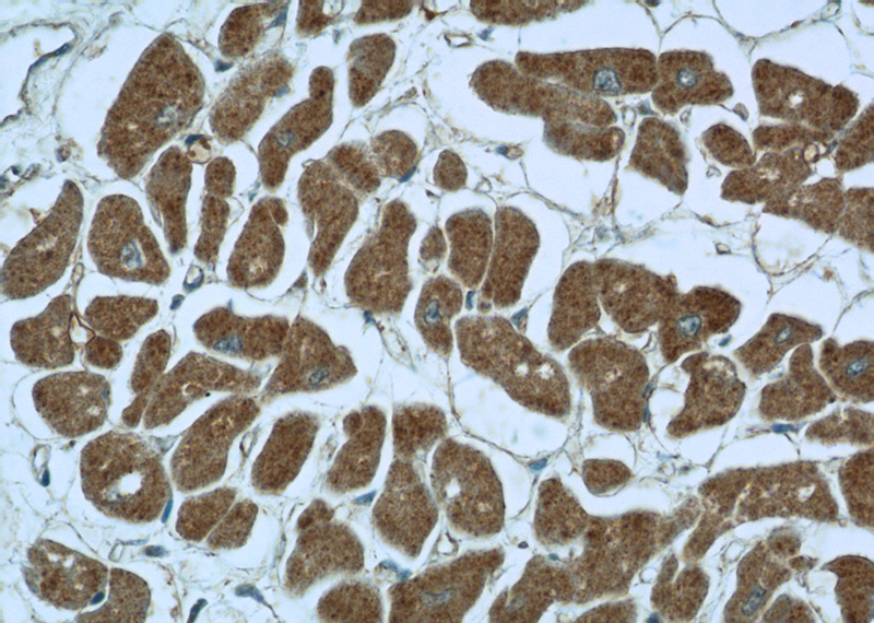 Immunohistochemistry of paraffin-embedded human heart slide using Catalog No:113626(PDK3 Antibody) at dilution of 1:50