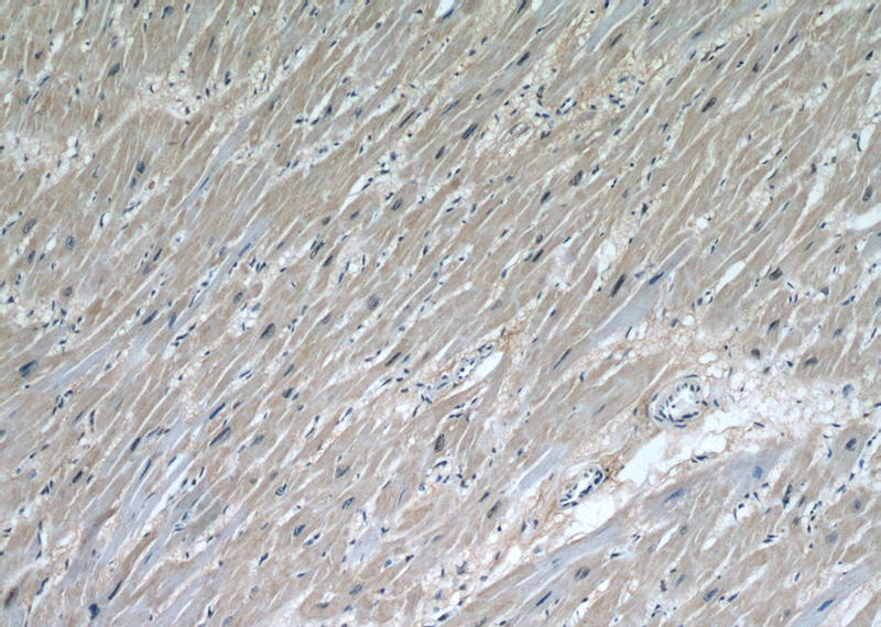 Immunohistochemical of paraffin-embedded human heart using Catalog No:115807(STUB1 antibody) at dilution of 1:50 (under 10x lens)