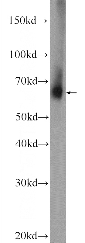 mouse brain tissue were subjected to SDS PAGE followed by western blot with Catalog No:116283(TMX3 Antibody) at dilution of 1:300