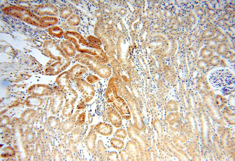 Immunohistochemical of paraffin-embedded human kidney using Catalog No:115483(SNX5 antibody) at dilution of 1:100 (under 10x lens)