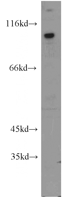 Jurkat cells were subjected to SDS PAGE followed by western blot with Catalog No:110496(EWS antibody) at dilution of 1:600