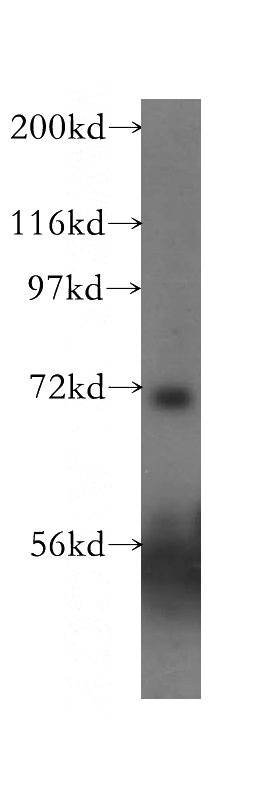 A375 cells were subjected to SDS PAGE followed by western blot with Catalog No:108230(ACCN4 antibody) at dilution of 1:400