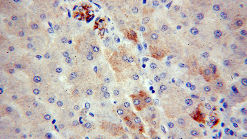 Immunohistochemical of paraffin-embedded human liver using Catalog No:108022(APOA4 antibody) at dilution of 1:100 (under 40x lens)