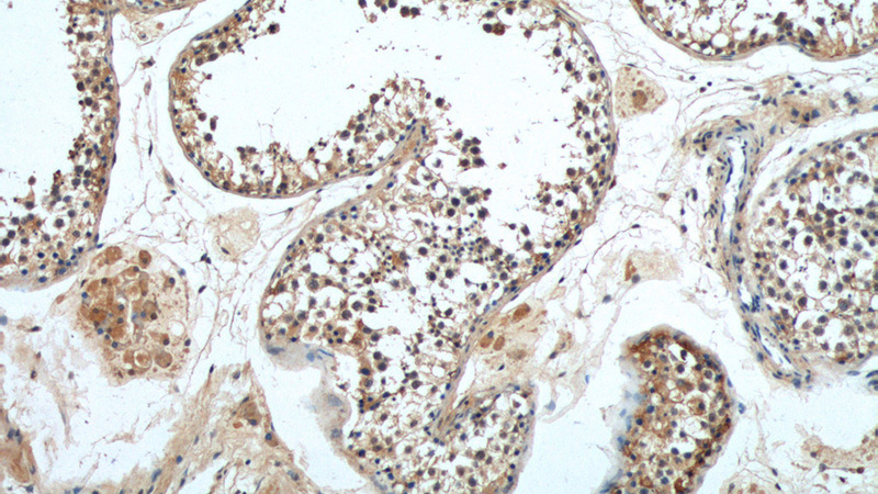 Immunohistochemistry of paraffin-embedded human testis tissue slide using Catalog No:112452(MAGEF1 Antibody) at dilution of 1:162 (under 10x lens)