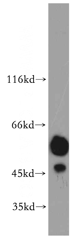 HT-1080 cells were subjected to SDS PAGE followed by western blot with Catalog No:114194(PRKACB antibody) at dilution of 1:1000