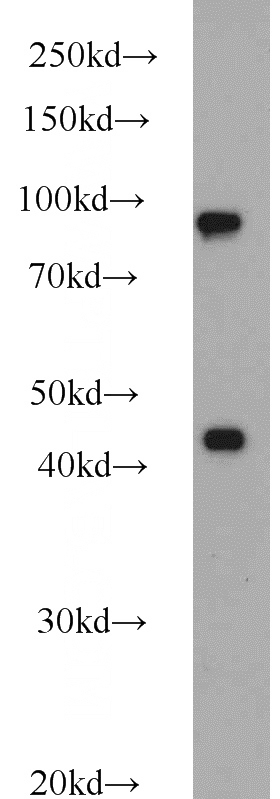 HeLa cells were subjected to SDS PAGE followed by western blot with Catalog No:113617(PBXIP1 antibody) at dilution of 1:1000