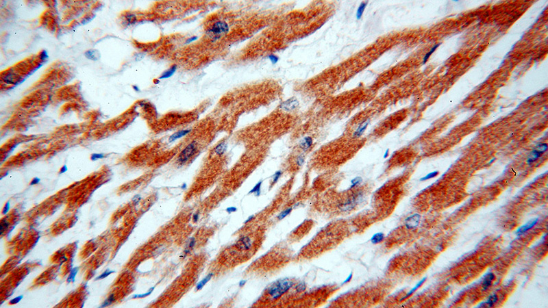 Immunohistochemical of paraffin-embedded human heart using Catalog No:110802(GABARAPL2-Specific antibody) at dilution of 1:50 (under 40x lens)