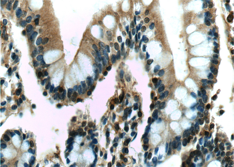 Immunohistochemistry of paraffin-embedded human small intestine tissue slide using Catalog No:107393(IL22RA2 Antibody) at dilution of 1:50 (under 40x lens)