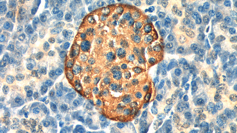 Immunohistochemistry of paraffin-embedded human pancreas tissue slide using Catalog No:107157(CHGA Antibody) at dilution of 1:200 (under 40x lens).
