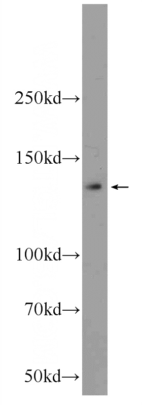 HeLa cells were subjected to SDS PAGE followed by western blot with Catalog No:111988(KIAA1033 Antibody) at dilution of 1:300