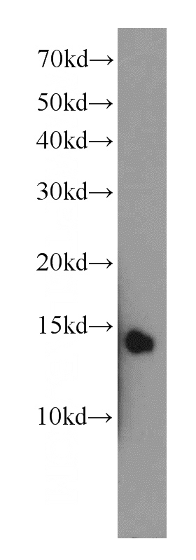 human brain tissue were subjected to SDS PAGE followed by western blot with Catalog No:116650(UBL3 antibody) at dilution of 1:1500