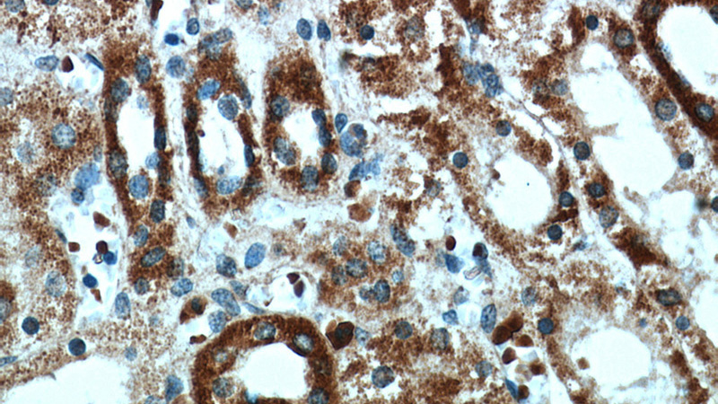 Immunohistochemical of paraffin-embedded human kidney using Catalog No:109350(CLEC18A antibody) at dilution of 1:50 (under 40x lens)