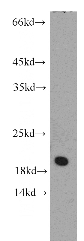 K-562 cells were subjected to SDS PAGE followed by western blot with Catalog No:108195(ARL1 antibody) at dilution of 1:500