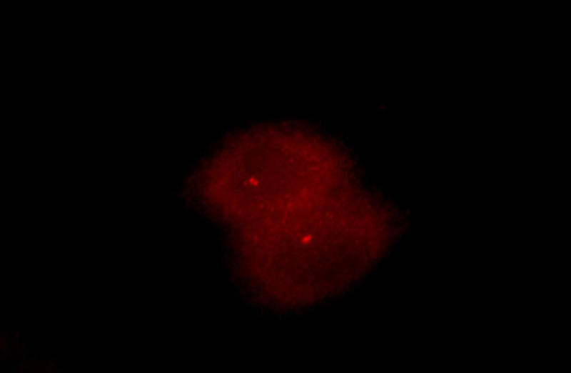 Immunofluorescent analysis of Hela cells, using NEK2 antibody Catalog No:113103 at 1:25 dilution and Rhodamine-labeled goat anti-rabbit IgG (red).